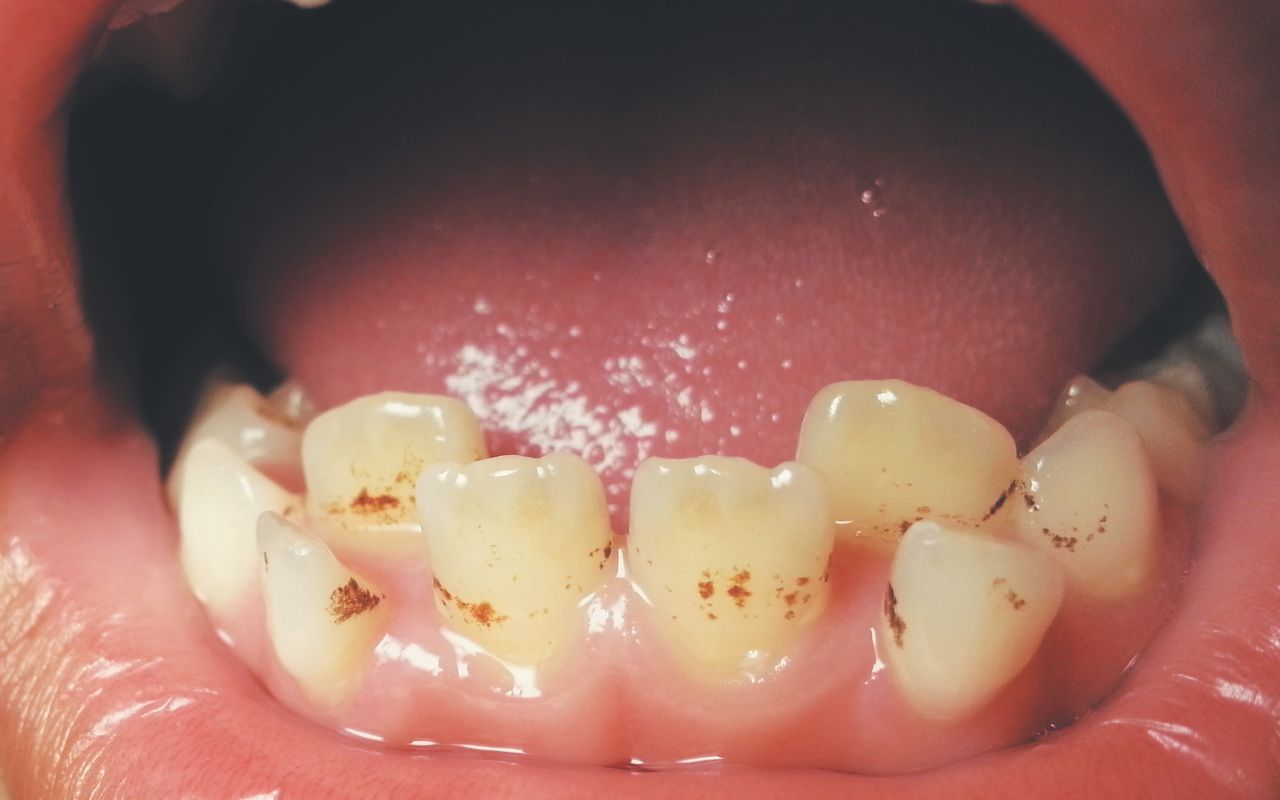 A dentist cleaning a woman's teeth, emphasizing the routine dental care and patient-dentist interaction.