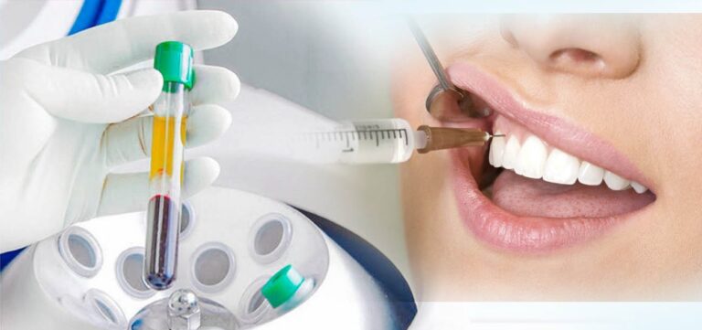 A woman is having her teeth cleaned with a toothbrush, showcasing proper dental hygiene practices.