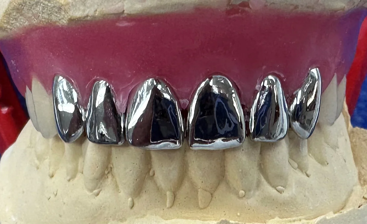 Close-up of metal teeth showcasing their intricate design and shiny surface, highlighting durability and craftsmanship.