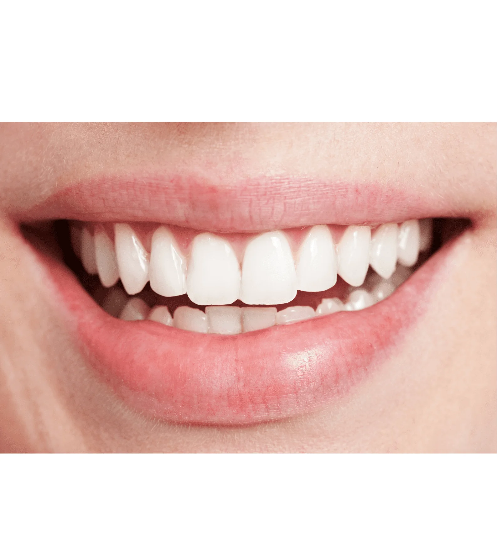 Chiclets for Teeth: Everything You Need to Know